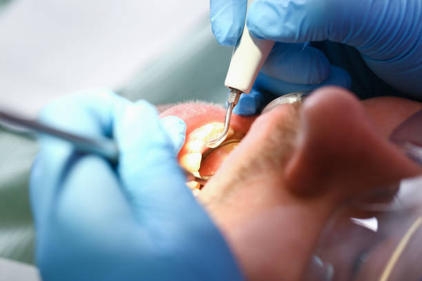 Best Weekend Emergency Dentist in Ivanhoe, TX