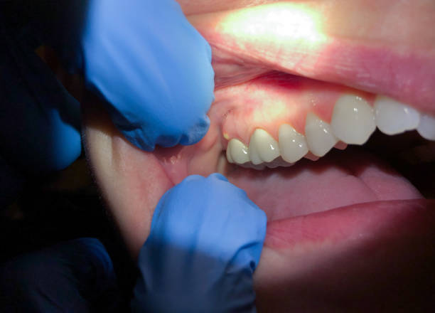 Best Orthodontic Emergency Dentist in Ivanhoe, TX