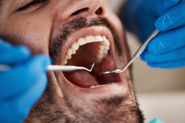 Best Emergency Dentist for Lost Fillings or Crowns in Ivanhoe, TX