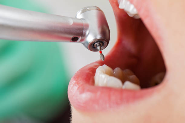 Best Urgent Dental Care for Toothache in Ivanhoe, TX